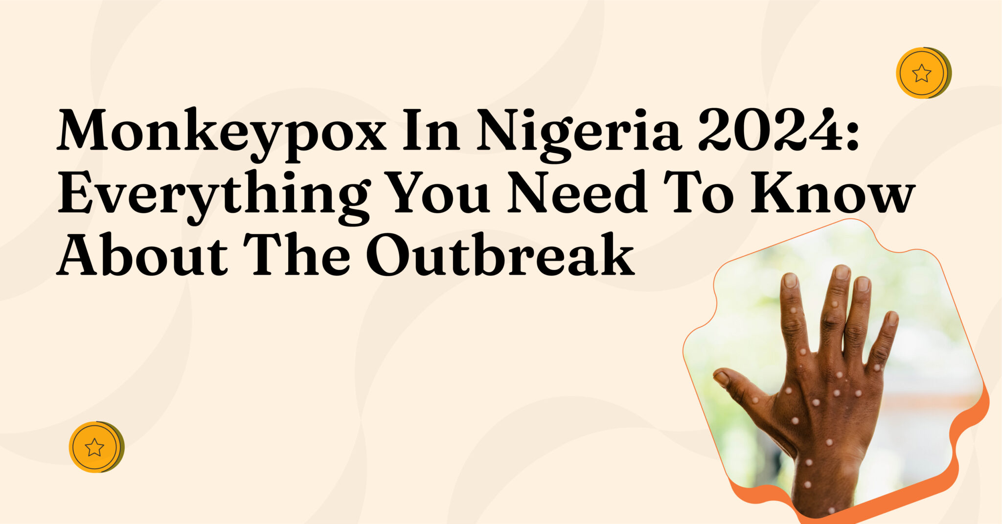 Monkeypox In Nigeria 2024 Everything You Need To Know About The