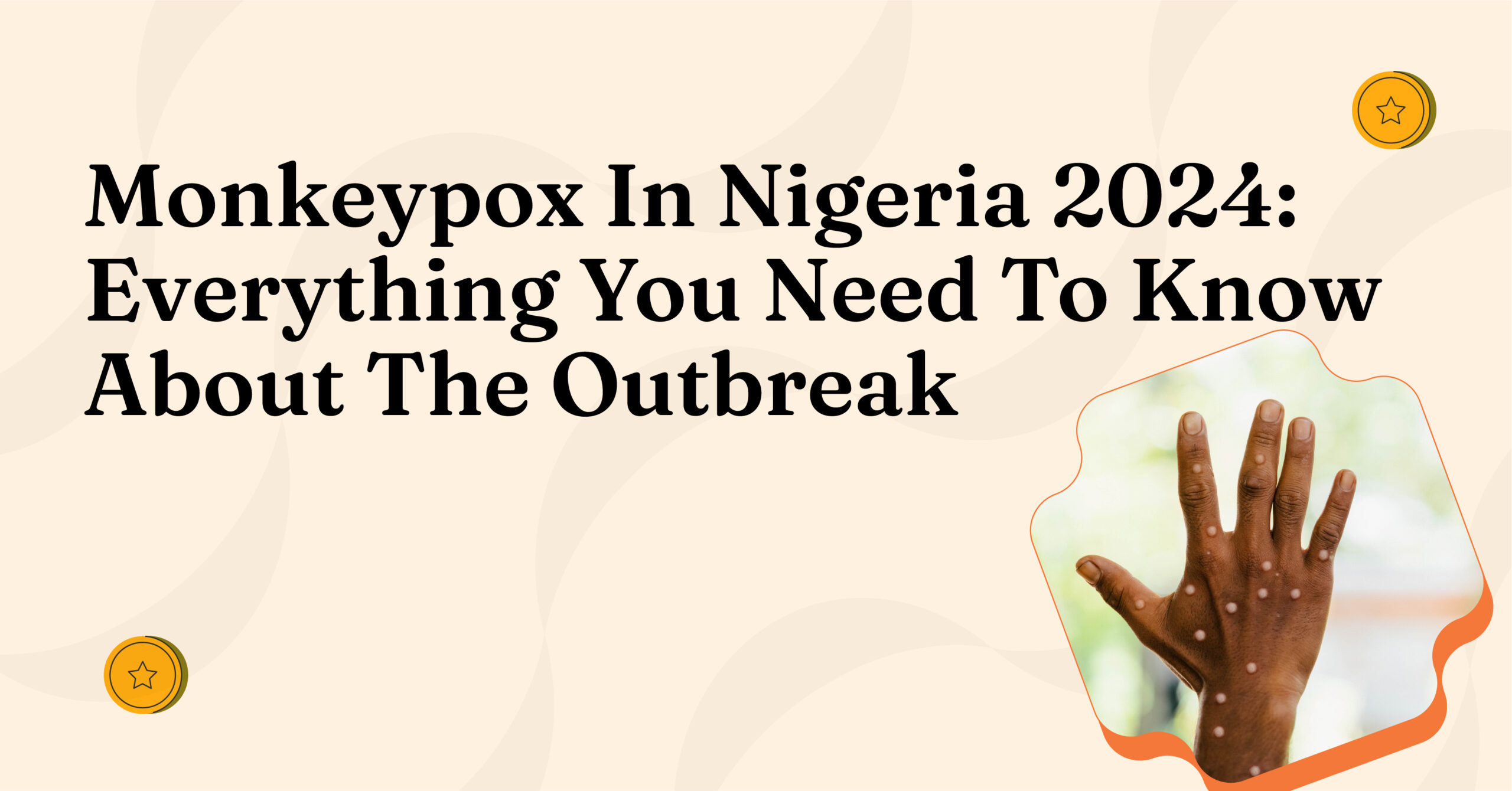 Monkeypox In Nigeria 2024: Everything You Need To Know About The Outbreak